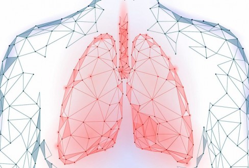 καρκίνος πνεύμονα COVID-19