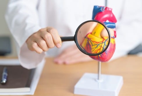Ιατρός πραγματοποιεί εξέταση σε ομοίωμα καρδιάς για επεμβατική θεραπεία κατάλυσης κολπικής μαρμαρυγής