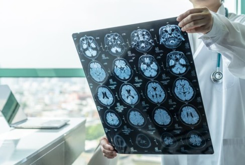 Νευρολόγος εξετάζει MRI προκειμένου να εντοπίσει εστίες εγκεφάλου
