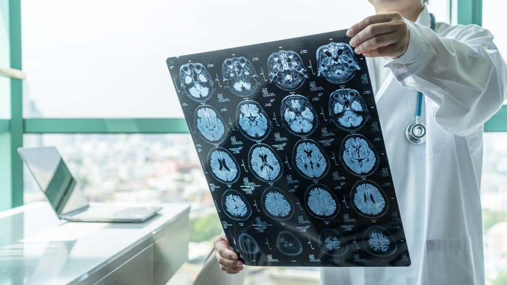Νευρολόγος εξετάζει MRI προκειμένου να εντοπίσει εστίες εγκεφάλου